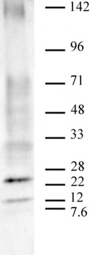 AbFlex Ubiquitin antibody (rAb)