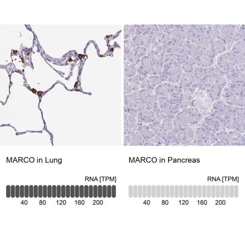 Immunohistochemistry analysis in human l