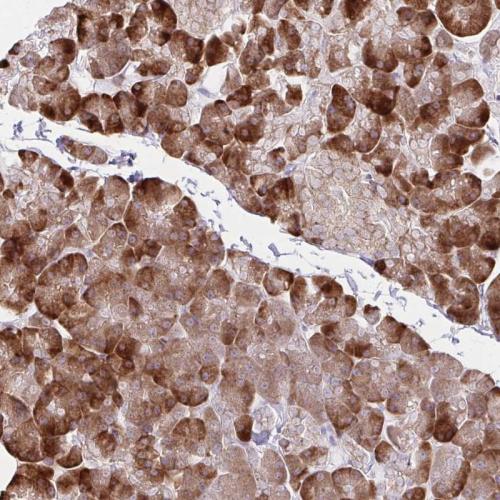 Immunohistochemical staining of human pa