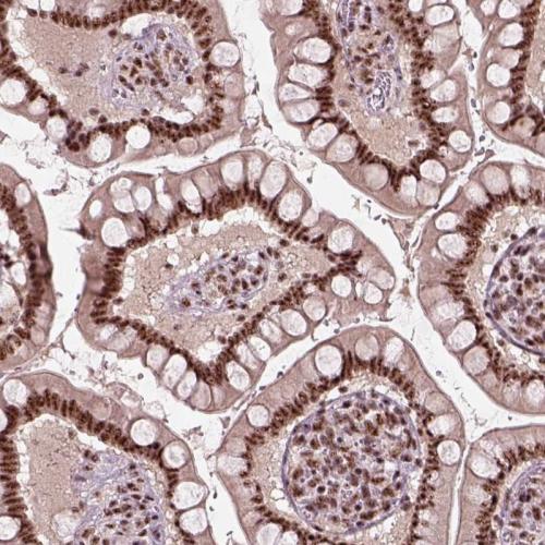 Immunohistochemical staining of human sm