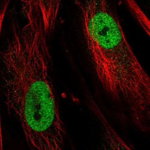 Immunofluorescent staining of human cell