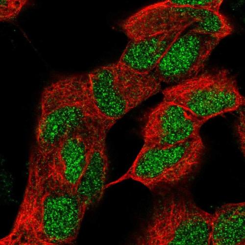 Immunofluorescent staining of human cell