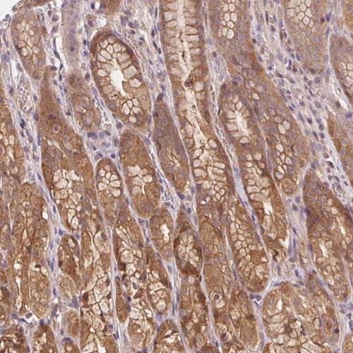 Immunohistochemical staining of human st