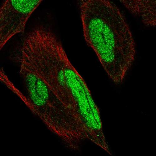 Immunofluorescent staining of human cell