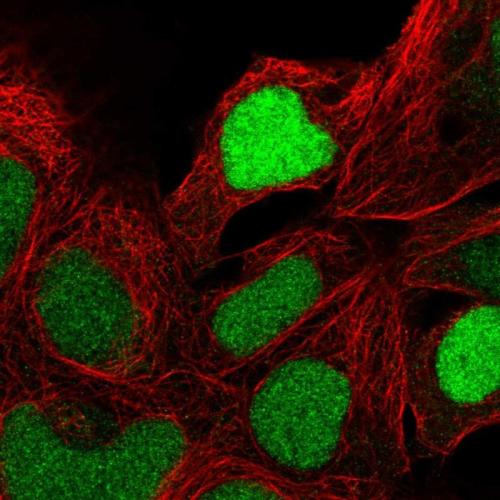 Immunofluorescent staining of human cell