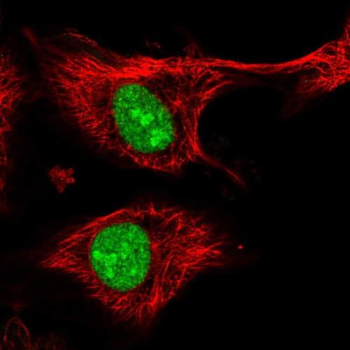 Immunofluorescent staining of human cell