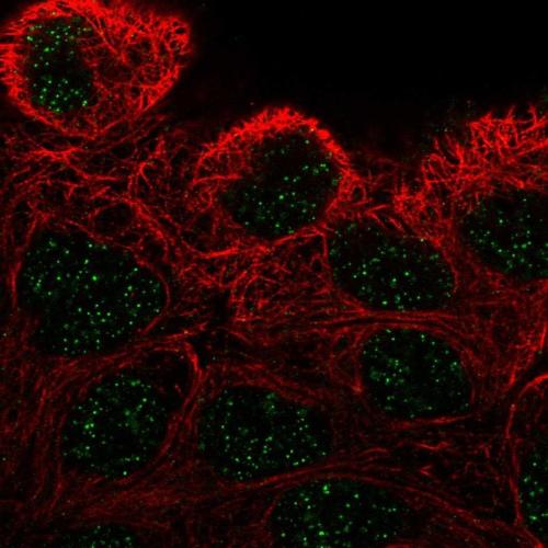 Immunofluorescent staining of human cell