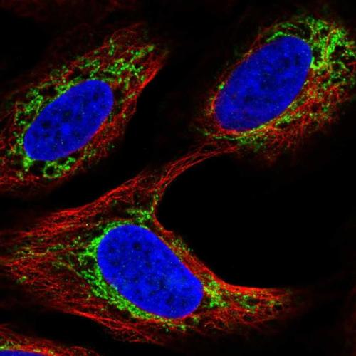 Immunofluorescent staining of human cell