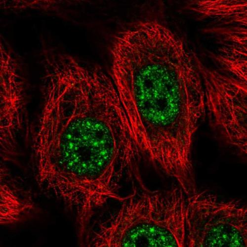 Immunofluorescent staining of human cell
