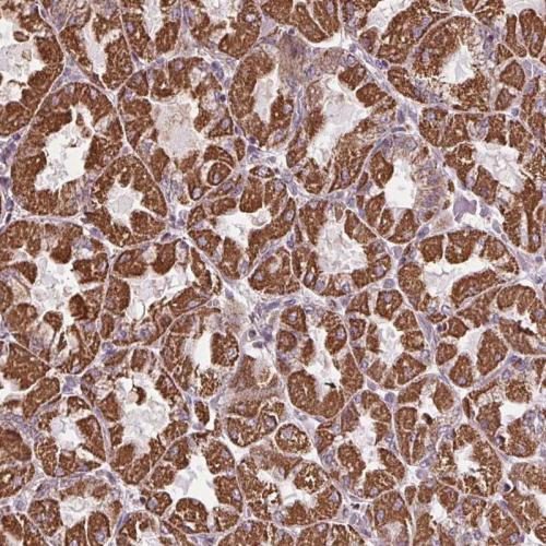 Immunohistochemical staining of human st