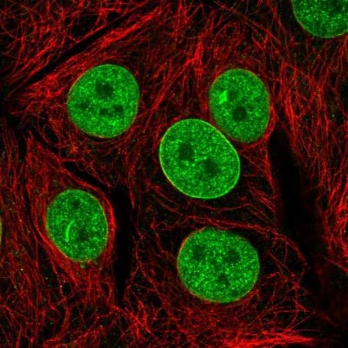 Immunofluorescent staining of human cell