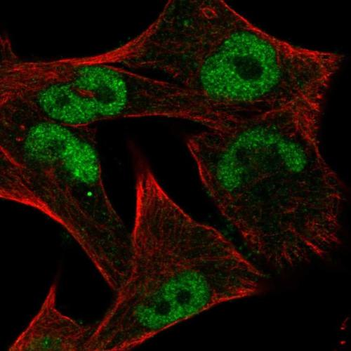 Immunofluorescent staining of human cell