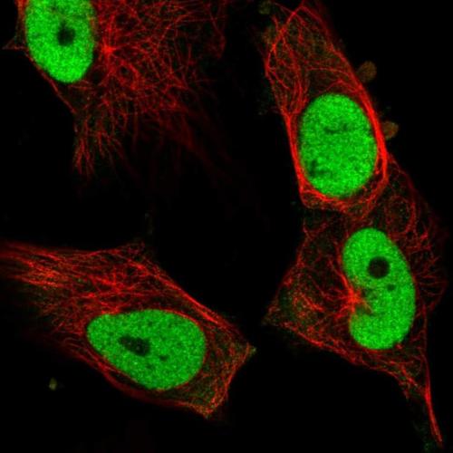 Immunofluorescent staining of human cell