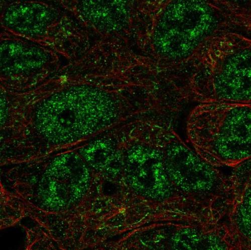 Immunofluorescent staining of human cell