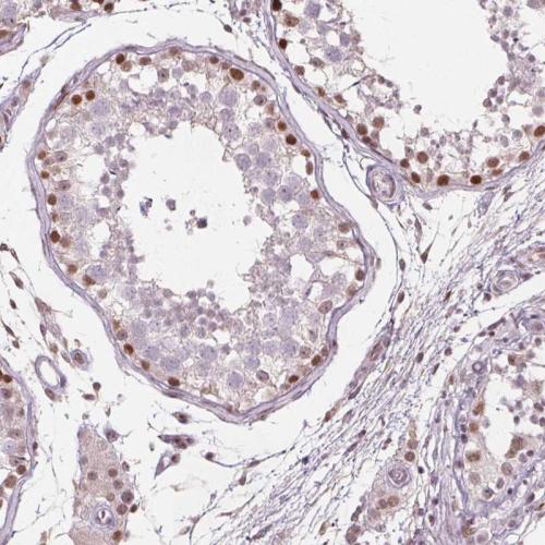 Immunohistochemical staining of human te