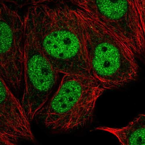 Immunofluorescent staining of human cell