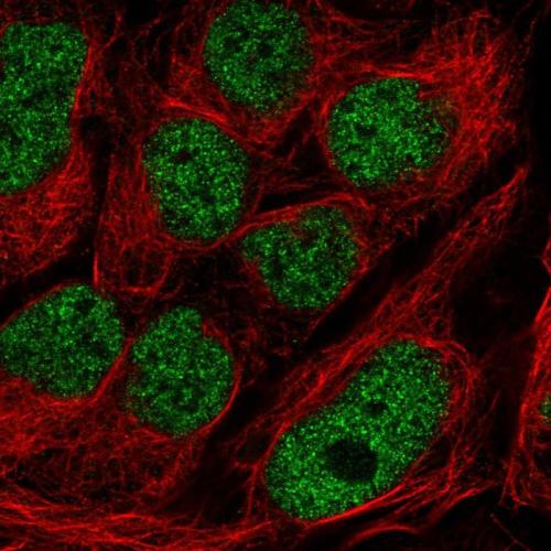Immunofluorescent staining of human cell