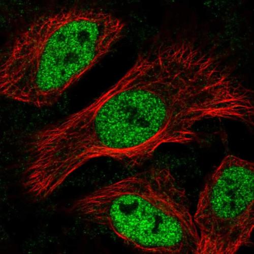 Immunofluorescent staining of human cell