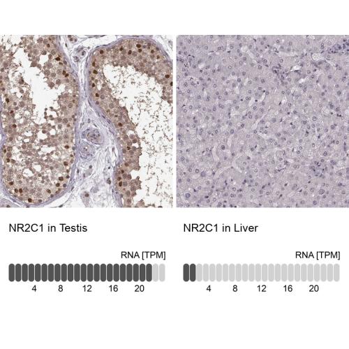 Immunohistochemistry analysis in human t