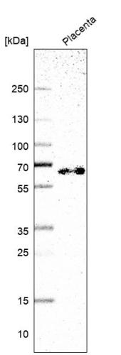 Western blot analysis in human placenta 