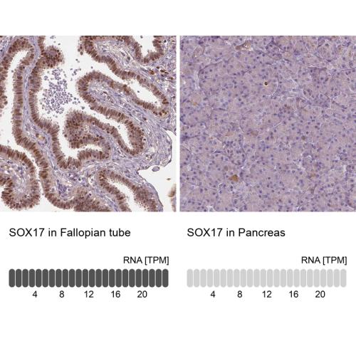 Immunohistochemistry analysis in human f