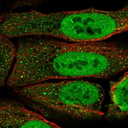 Immunofluorescent staining of human cell