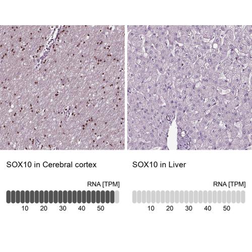 Immunohistochemistry analysis in human c