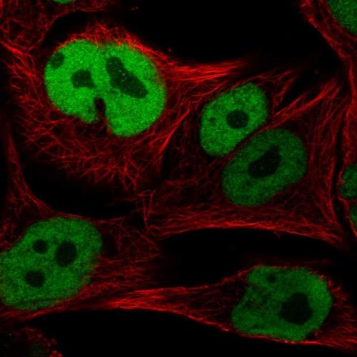 Immunofluorescent staining of human cell