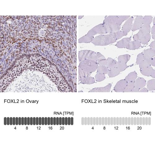 Immunohistochemistry analysis in human o