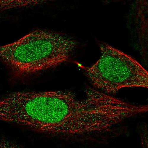 Immunofluorescent staining of human cell