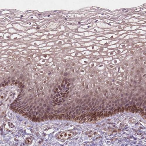 Immunohistochemical staining of human ce