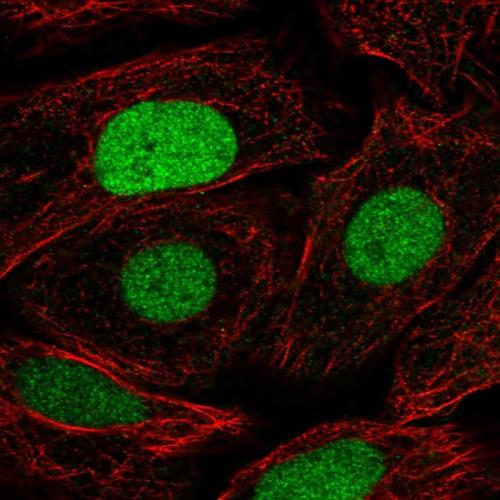 Immunofluorescent staining of human cell