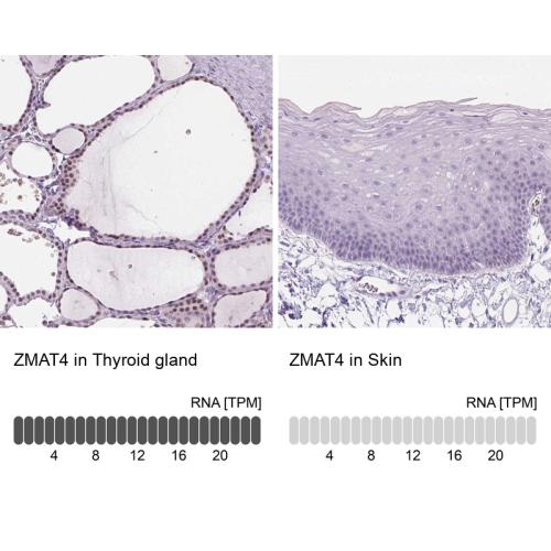Immunohistochemistry analysis in human t