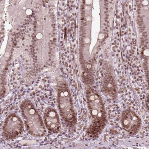 Immunohistochemical staining of human du