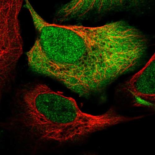 Immunofluorescent staining of human cell