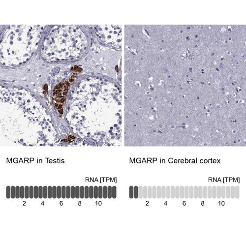 Immunohistochemistry analysis in human t