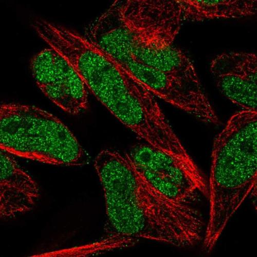 Immunofluorescent staining of human cell