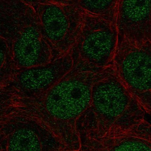 Immunofluorescent staining of human cell