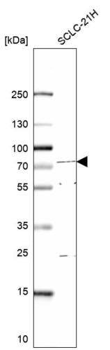 Western blot analysis in human cell line