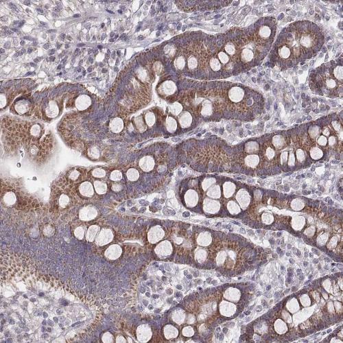 Immunohistochemical staining of human du