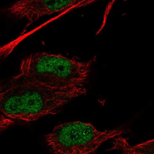 Immunofluorescent staining of human cell