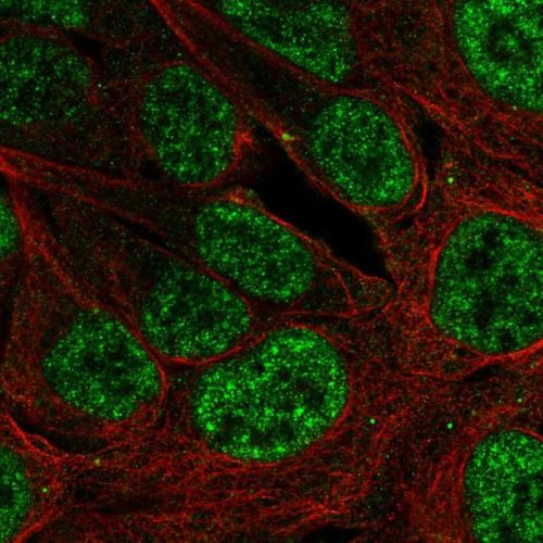 Immunofluorescent staining of human cell