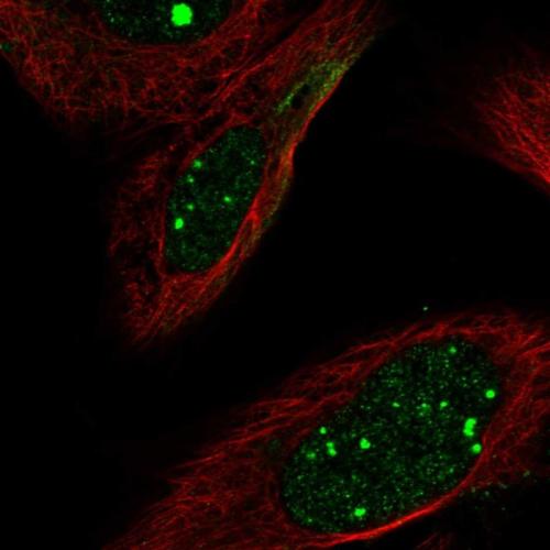 Immunofluorescent staining of human cell