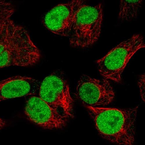 Immunofluorescent staining of human cell