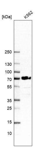 Western blot analysis in human cell line