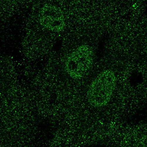 Immunofluorescent staining of human cell