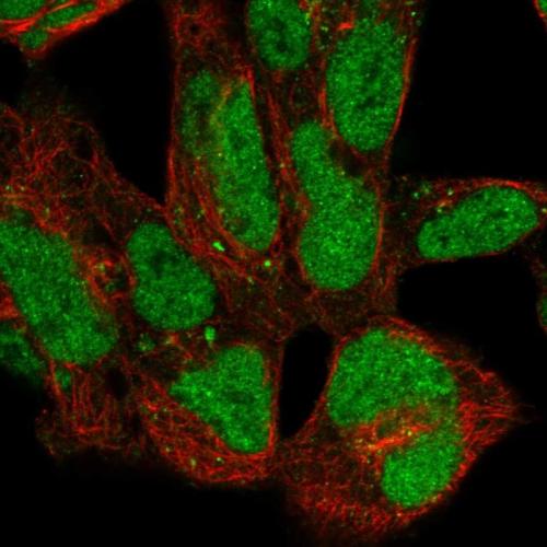 Immunofluorescent staining of human cell