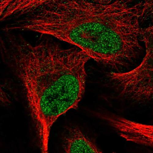Immunofluorescent staining of human cell