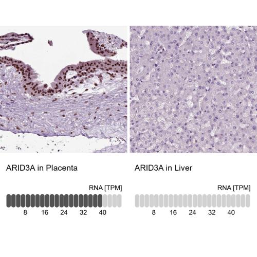 Immunohistochemistry analysis in human p