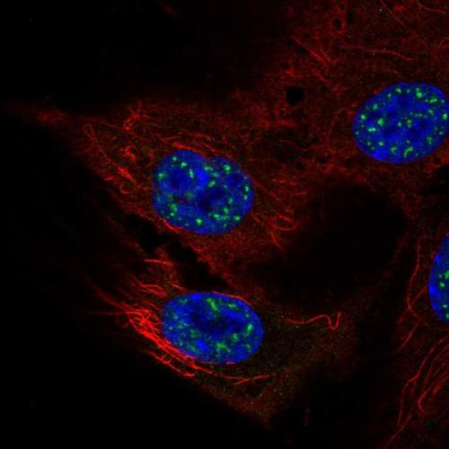 Immunofluorescent staining of human cell